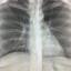 radiologyinplainenglish.com