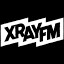 xray.fm